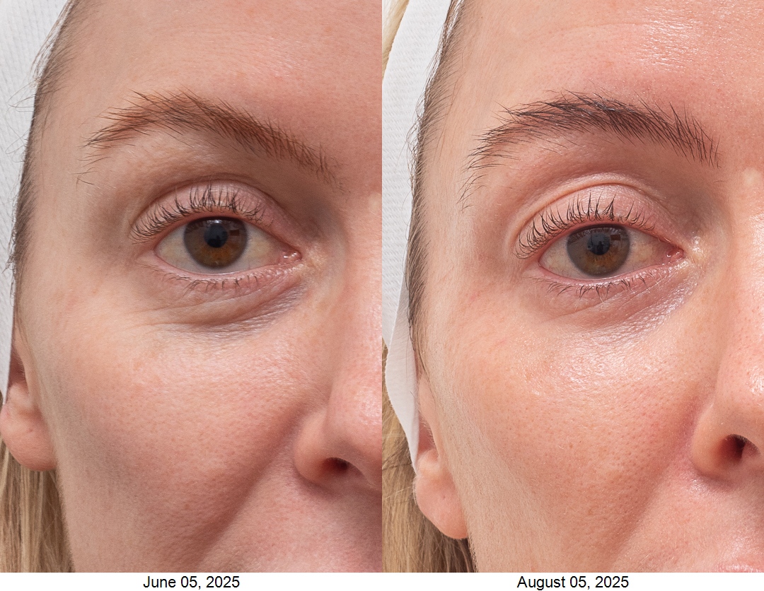 2465-SD-111188-CO2-EYE-WITH-DATE