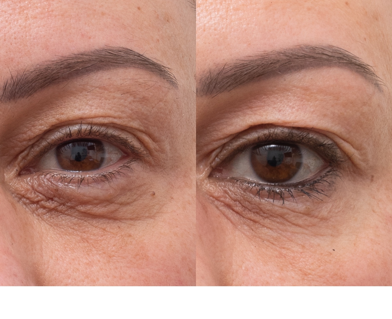 2475-MS-010480-co2-eye-L