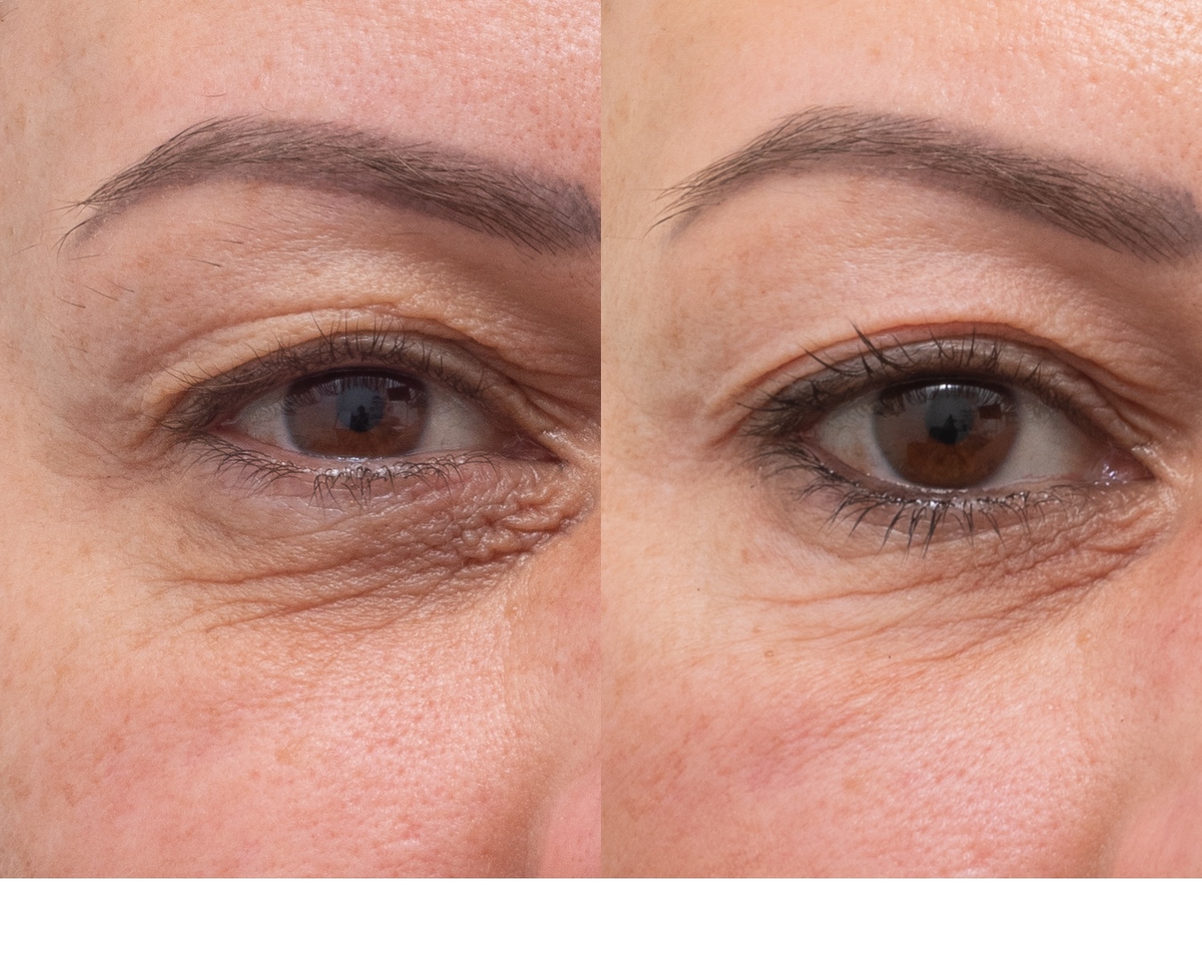 2475-MS-010480-co2-eye-R