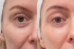 2465-SD-111188-CO2-EYE-WITH-DATE