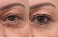 2475-MS-010480-co2-eye-L