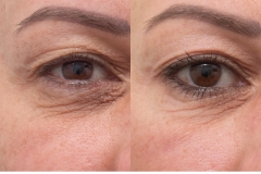 2475-MS-010480-co2-eye-R