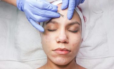 Dermatology Treatment