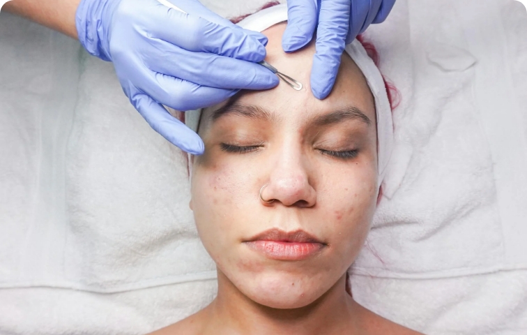 treatment card image 2