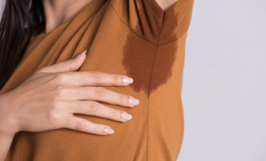 Hyperhidrosis