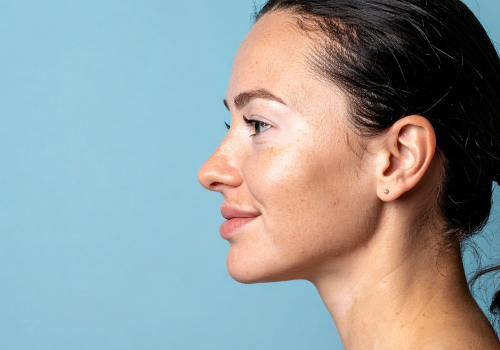 Vitiligo Repigmentation Programme