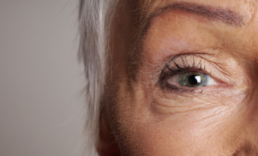 eye rejuvenation