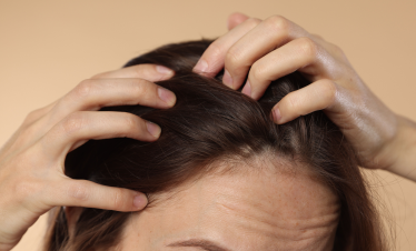 Hair loss Dermatologist